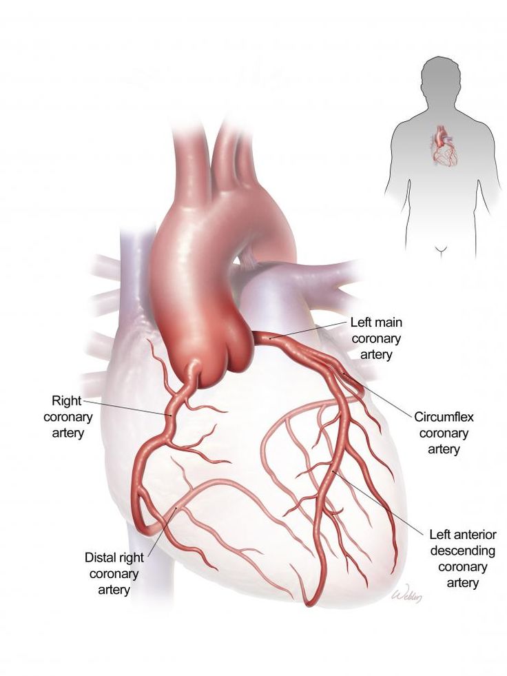 CT Coronary Angiography Cost in Delhi — From … — image 1