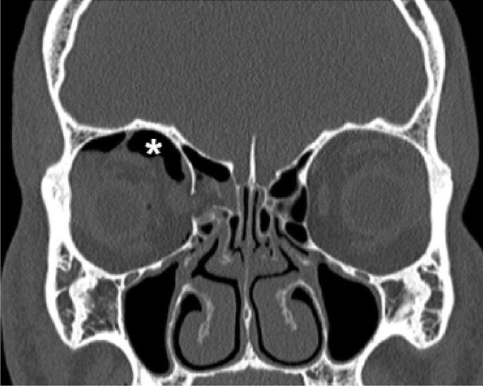 CT Scan Head Orbit @ 3,500/- Only | … — image 1
