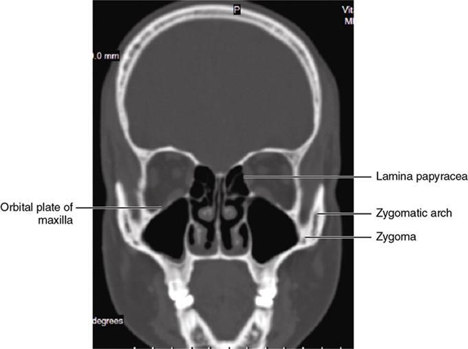 CT Scan Head Orbit @ 3,500/- Only | … — image 3