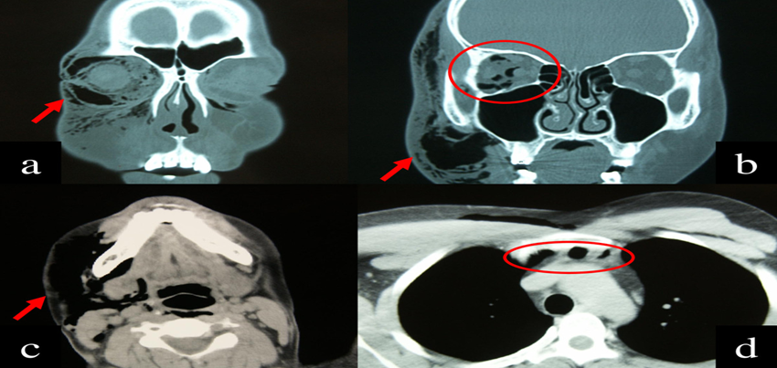 CT Scan Head Orbit @ 3,500/- Only | … — image 4