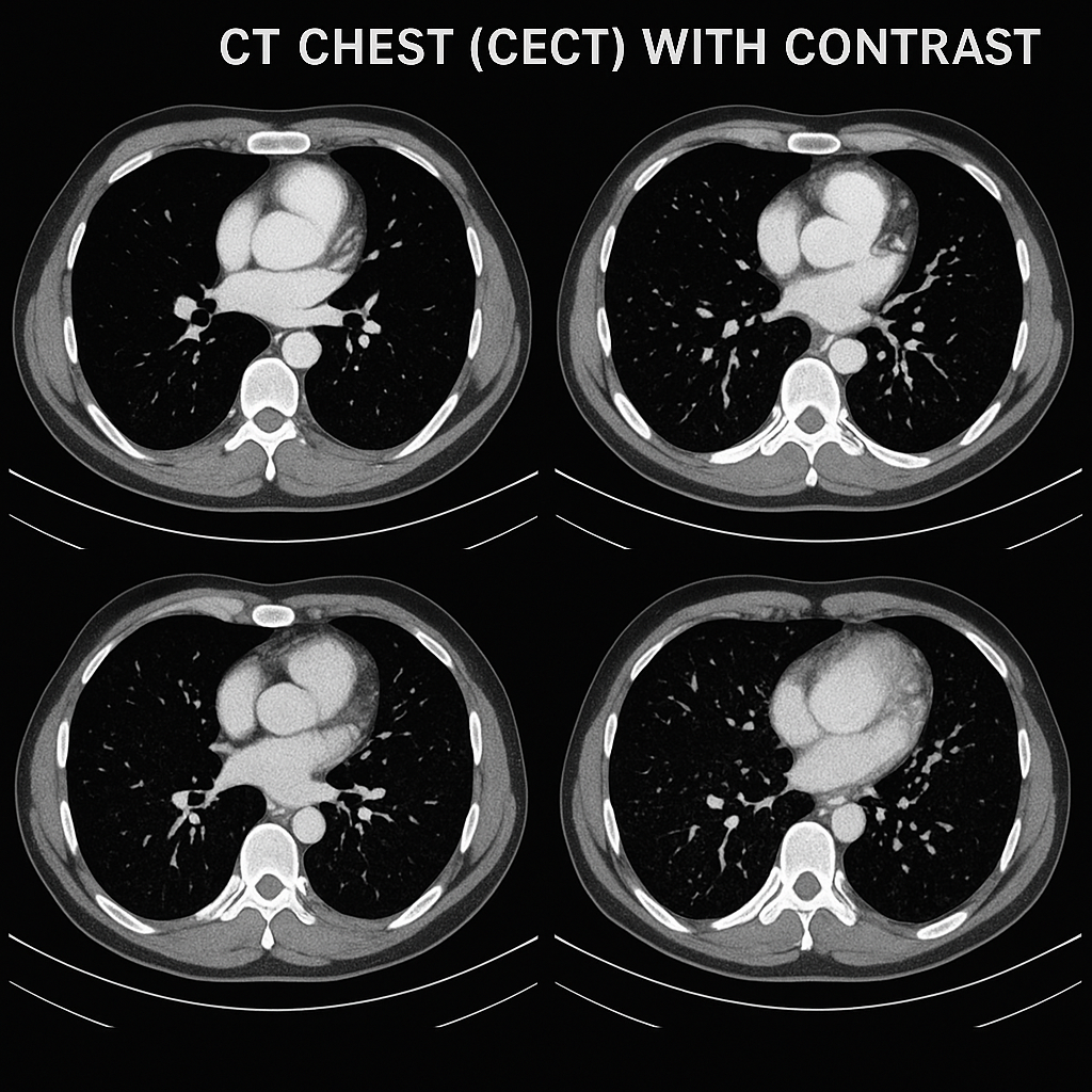 CECT Chest Cost in Delhi 2026 — Plain … — image 3