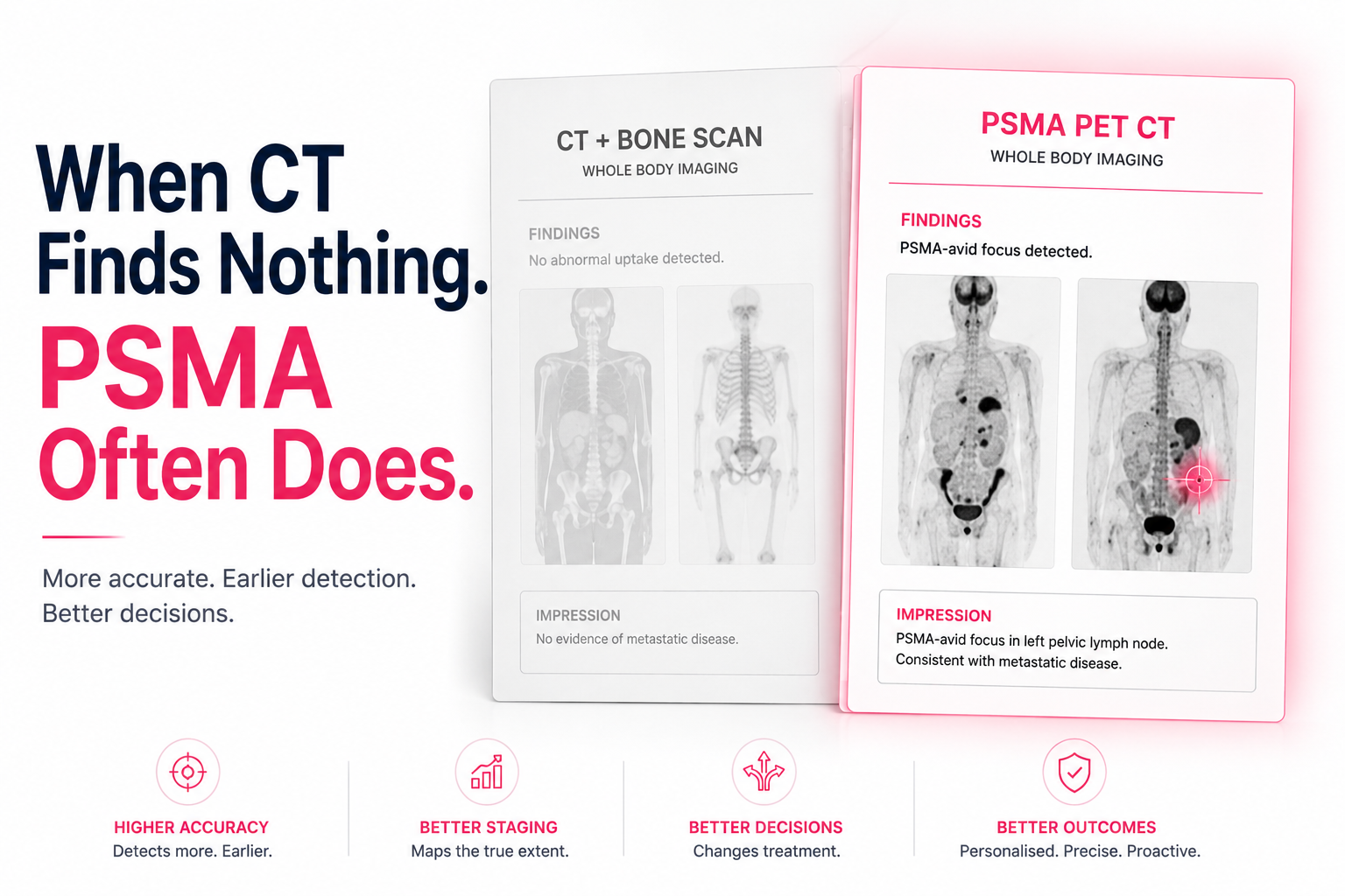 PET CT Scan for Prostate Cancer in Delhi — PSMA …