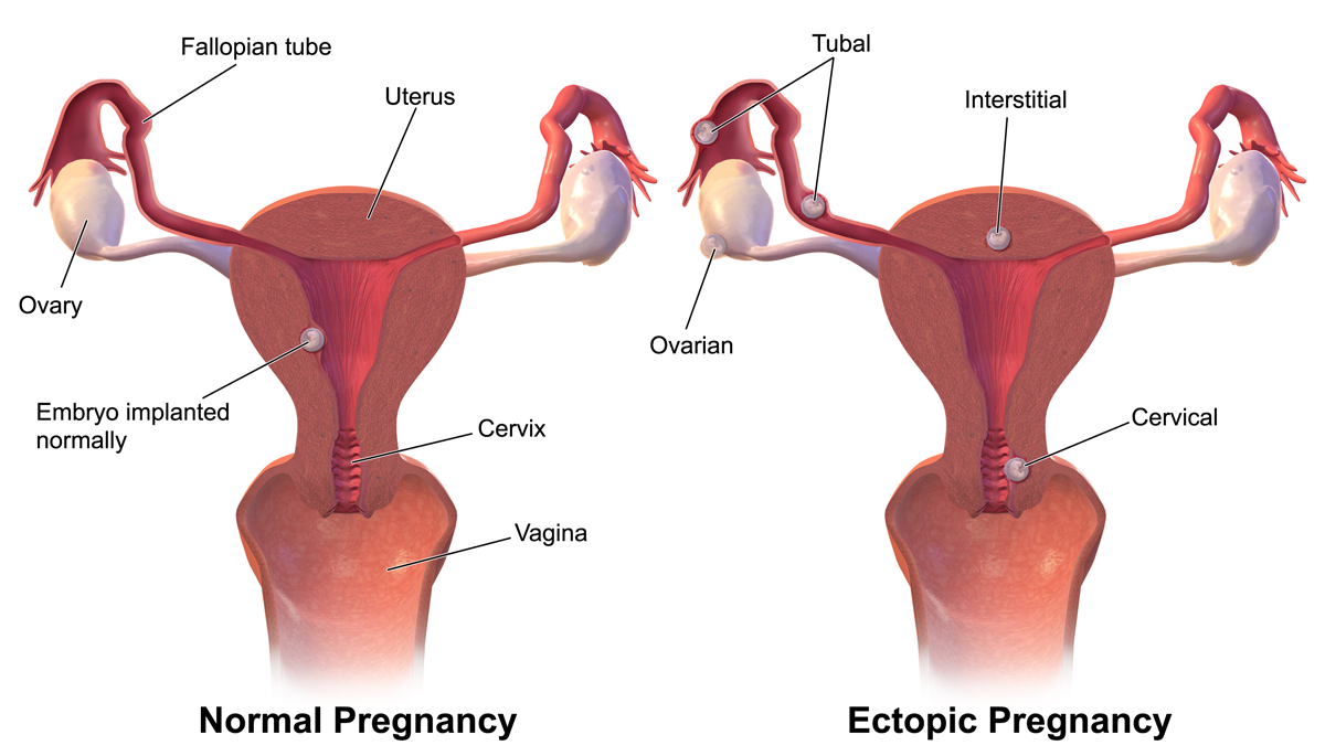 Ultrasound TVS | Pregnancy Tests | From Rs. 1000.