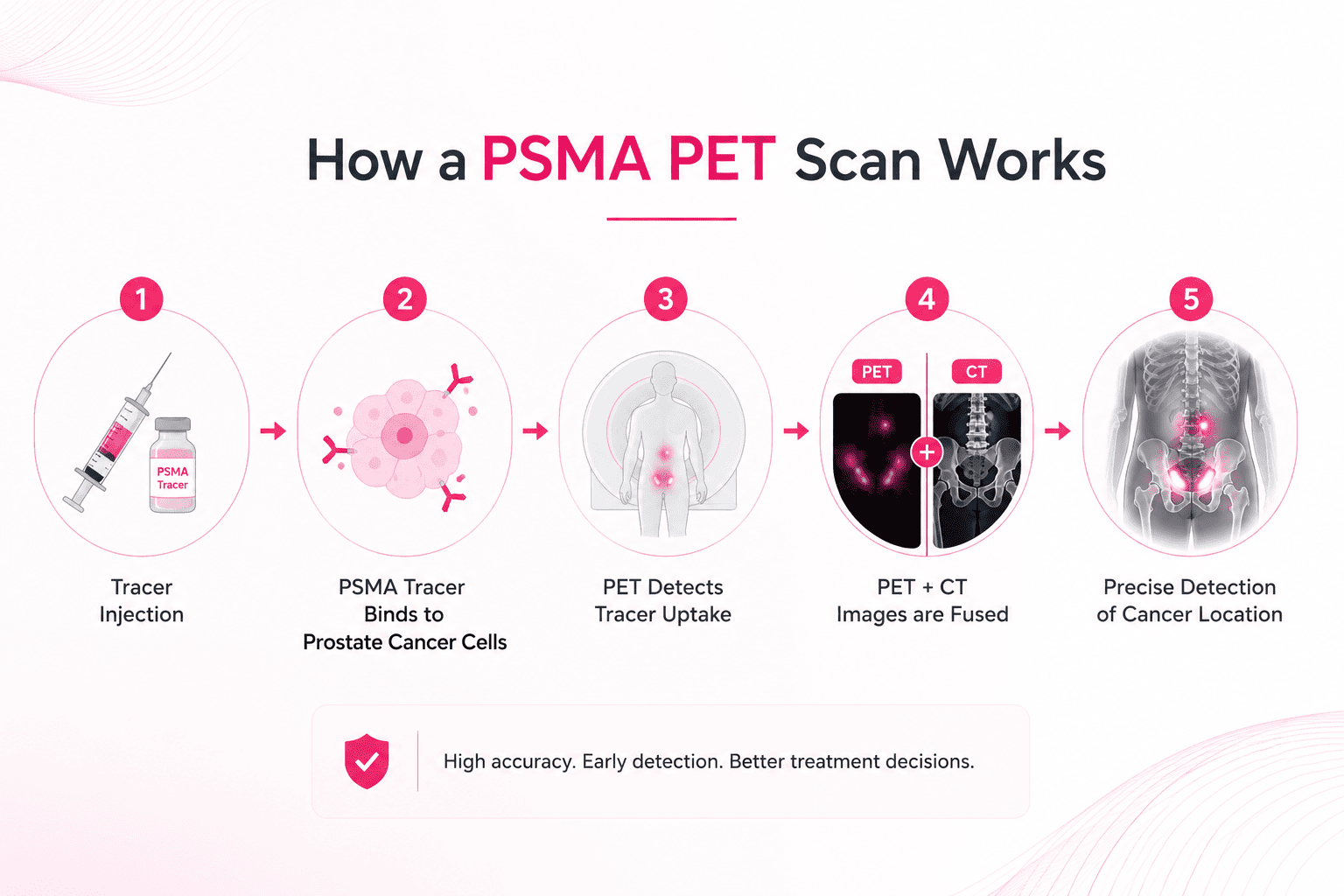 PSMA PET Scan PSMA PET Scan