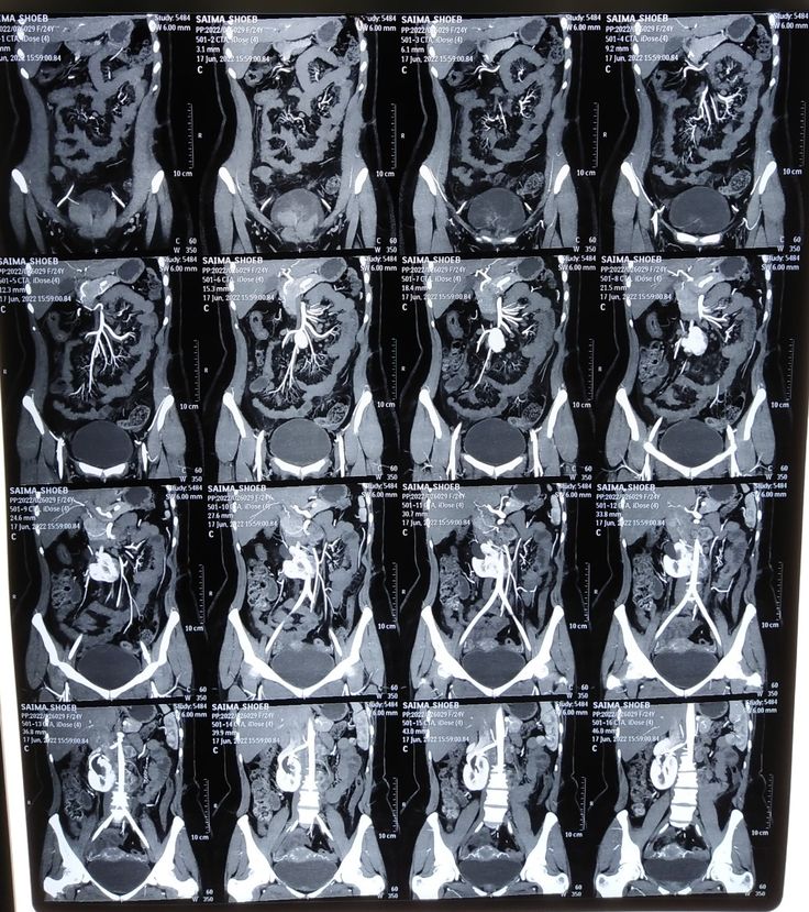 CECT Chest Cost in Delhi 2026 — Plain … — image 1