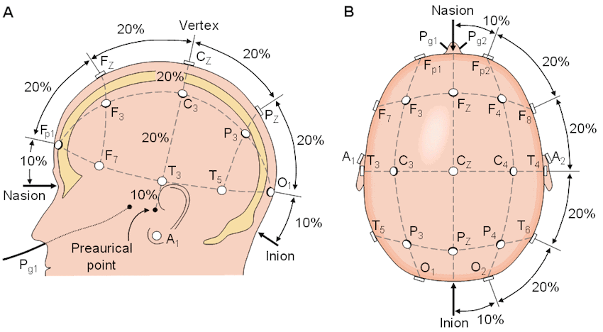 EEG Done at Home in India — Is … — image 1