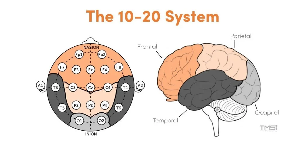 EEG Done at Home in India — Is … — image 3