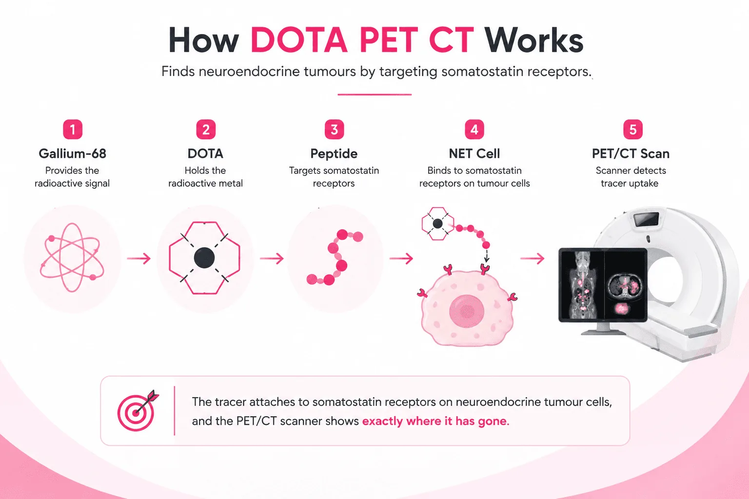 DOTA PET CT Scan